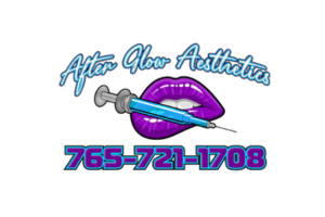 After Glow Asthetics logo